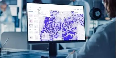 A scientist in a lab analyzes microscope images on a computer screen using AI.