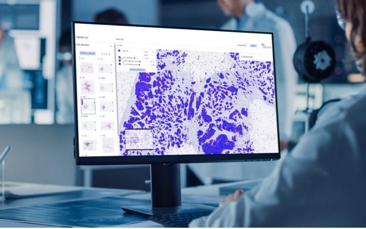 A scientist in a lab analyzes microscope images on a computer screen using AI.