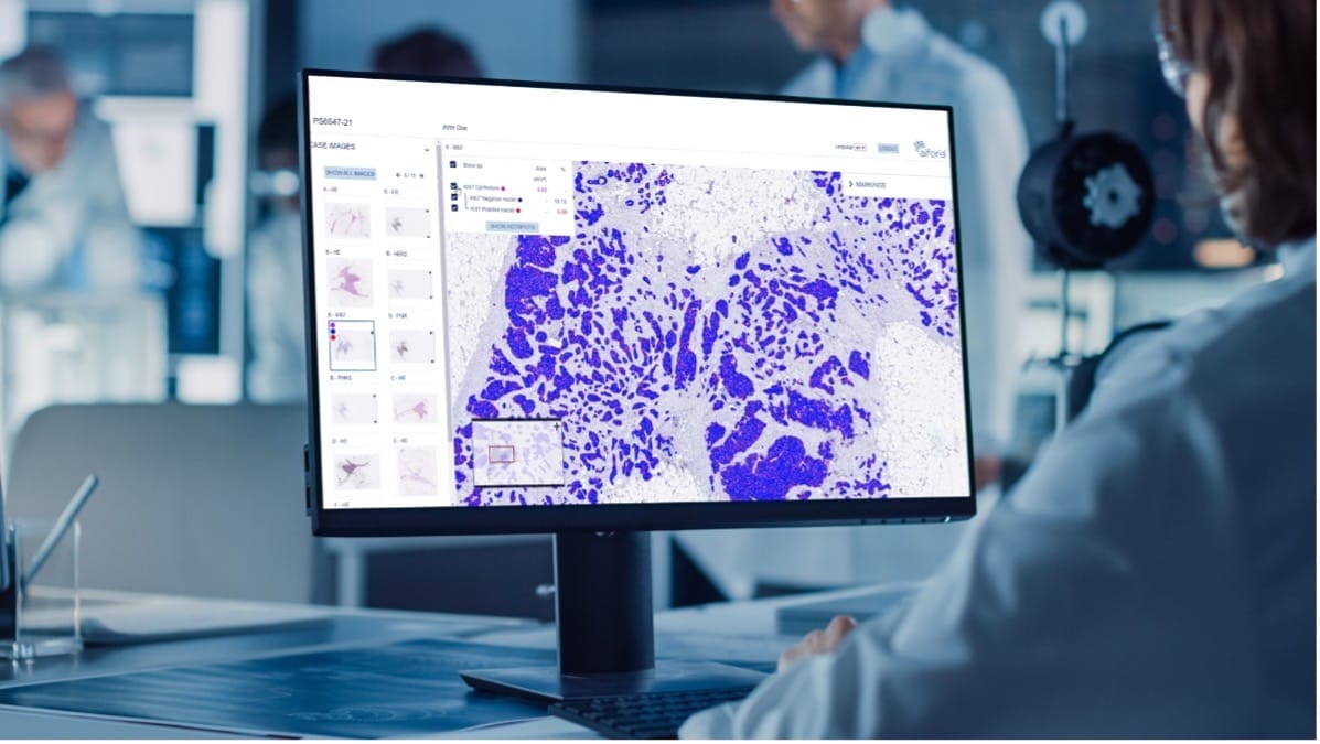 Where is the AI? A Look into the Field of Automatic Prostate Cancer Detection and the Role of Data